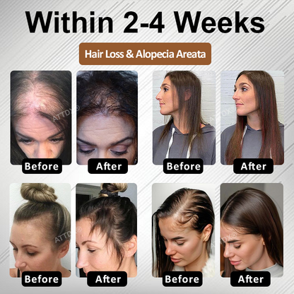 🔥TikTok Hot Sellers- ATTDX® Root Activator Hair Rescue Serum