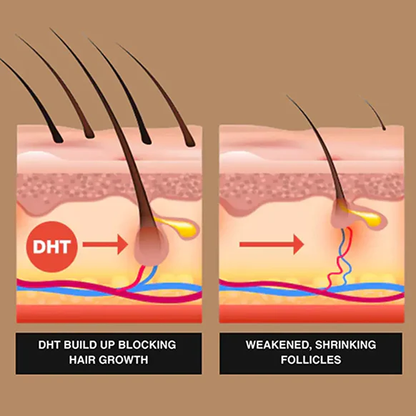 🔥TikTok Hot Sellers- ATTDX® Root Activator Hair Rescue Serum