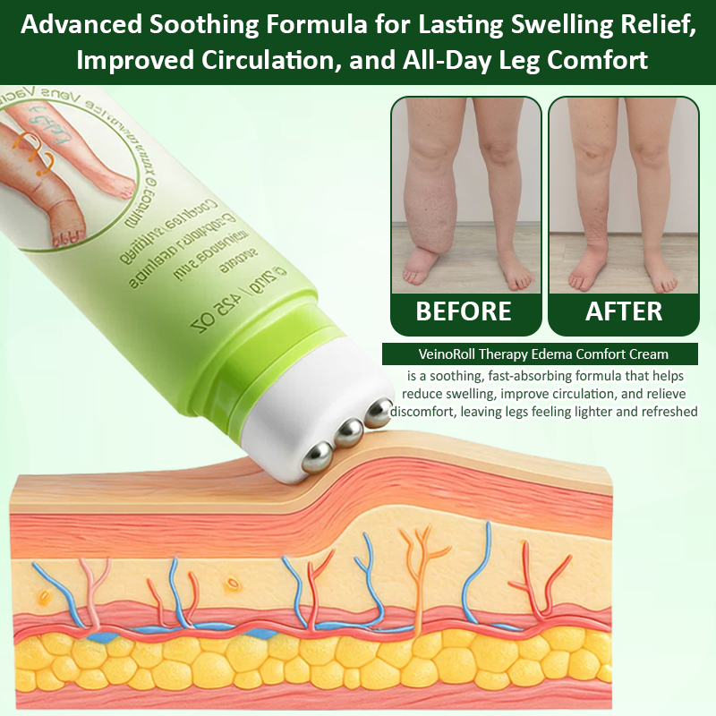 🔥TikTok Hot Sellers- ATTDX® VeinoRoll Therapy Edema Comfort Cream