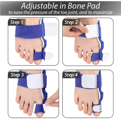 ArthroCareX™ Hallux Bunion Corrector