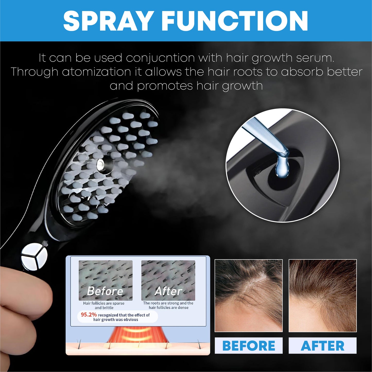 🔥TikTok Hot Sellers - ComfortCornerUs™ LightStim Scalp Therapy Massage Comb