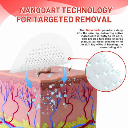 DermaEase™ NanoDart Skin Tag Removal Patches