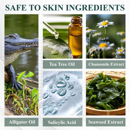 DermaEase™ Natureerase Instant Mole Spot Removal Gel