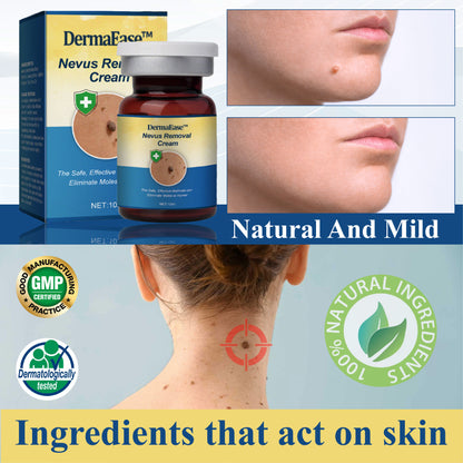 DermaEase™ Nevus Removal Cream