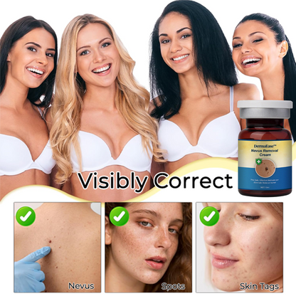 DermaEase™ Nevus Removal Cream
