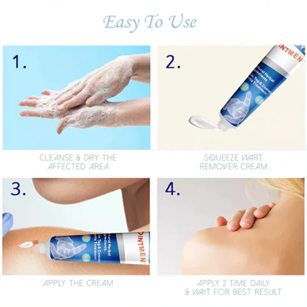 DermaEase™ WartsOff Instant Blemish Removal Cream