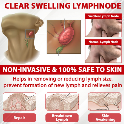 ATTDX® Horse Chestnut LymphoTherm Relief Gel