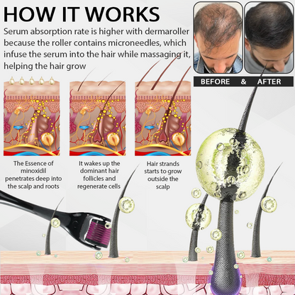 🔥TikTok Hot Sellers- ATTDX® Max Absorb MinoxidilSerum Dermaroller Kit