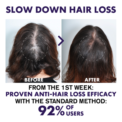 ATTDX™ Hair Regrowth Ginger Shampoo Bar