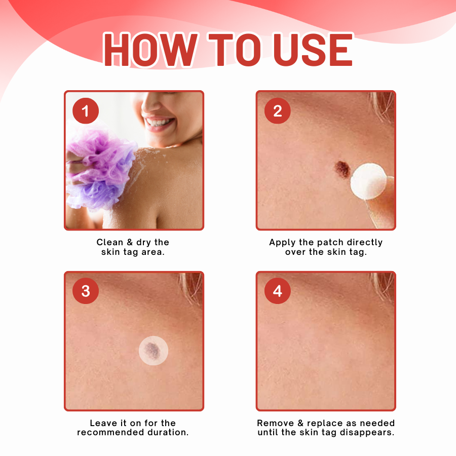 DermaEase™ NanoDart Skin Tag Removal Patches