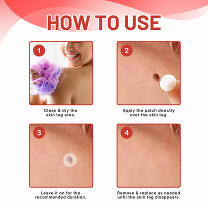 DermaEase™ NanoDart Skin Tag Removal Patches