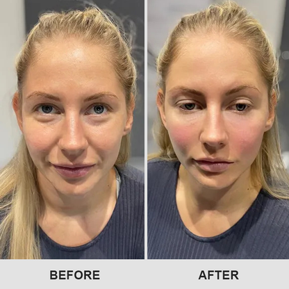 DermaEase™ Retinol Eye Stick