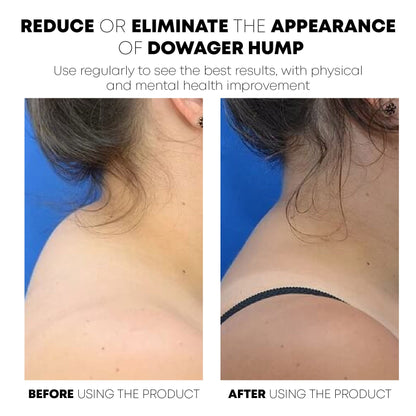 CircuWave™ UltraSpa Lymphvity PostureCorrector Neck Instrument